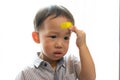 Children have ulcers on the head. Royalty Free Stock Photo