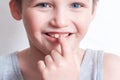 Children`s teeth, loss and fingers pointed at the incisor teeth, children`s mouths of child close up, incisor milk tooth missing Royalty Free Stock Photo