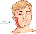 Children salivary gland swelling vector illustration