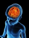 A childs brain Royalty Free Stock Photo
