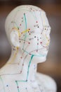 Chinese Acupuncture Medicine Royalty Free Stock Photo