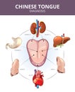 Chinese Tongue Diagnosis. Internal organs projections. Medical vector infographics