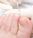 Chiropody Royalty Free Stock Photo
