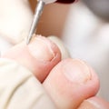 Chiropody Royalty Free Stock Photo