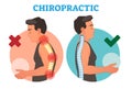 Chiropractic conceptual vector illustration with back bone curvature.