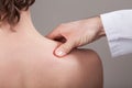 Chiropractic, osteopathy, manual therapy, acupressure. Royalty Free Stock Photo