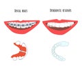 Two human mouth with dental braces and orthodontic transparent retainers on teeth.