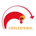 High cholesterol level of blocked blood vessel diagram Royalty Free Stock Photo