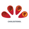 Cholesterol level meter gauge with blood vessel diagram Royalty Free Stock Photo