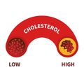 Cholesterol level meter gauge with blood vessel diagram Royalty Free Stock Photo