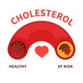 Cholesterol level meter gauge with blood vessel diagram Royalty Free Stock Photo