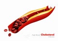 Cholesterol plaque in artery, 3d illustration.