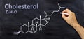 Cholesterol structural chemical formula, chalk drawing on a blackboard