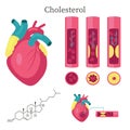 Cholesterol vector flat style design isolated illustration Royalty Free Stock Photo