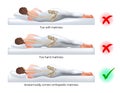 Choosing an orthopedic mattress for sleeping - Correct and incorrect sleeping position on the side, vector illustration.