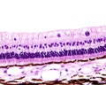 Choroid and retina