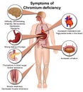 Chromium deficiency infographic, 3d medical vector illustration isolated on white background