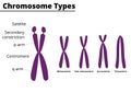 Chromosome parts and types didatic illustration. Royalty Free Stock Photo