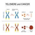 Chromosome and telomere for healthy and cancerous cells Royalty Free Stock Photo