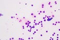 Chromosomes Human under the microscope.
