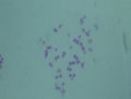 Chromosomes in the nucleus Royalty Free Stock Photo