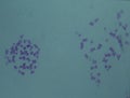 Chromosomes in the nucleus Royalty Free Stock Photo