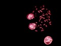 Chromosomes under fluorescence microscope, red colored Human chromosomes from blood