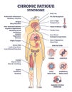 Chronic fatigue syndrome with symptom and risk factors list outline diagram