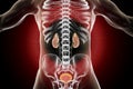 Chronic glomerulonephritis, gross pathology