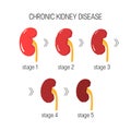 Chronic kidney disease vector Royalty Free Stock Photo