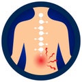 Medical infographic orthopedic; human silhouette. Abstract background with spine bone; cervical, Thoracic, Lumbar, and  Sacrum. Royalty Free Stock Photo