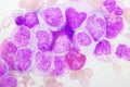 Chronic myeloid leukemia cells or CML