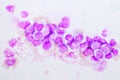 Chronic myeloid leukemia cells or CML