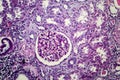 Chronic nephritis, light micrograph