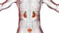 Chronic pyelonephritis, illustration