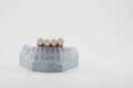 Cigarettes on teeth model Royalty Free Stock Photo