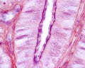 Ciliated columnar epithelium. Fallopian tube