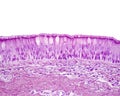 Ciliated pseudostratified columnar or respiratory epithelium