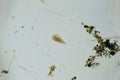 Ciliates Stentor found in freshwater pond