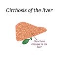 Cirrhosis of the liver. Vector illustration on background