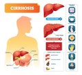 Cirrhosis vector illustration. Labeled medical diagram with illness symptom