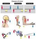 Classes of lever infographic diagram for physics science education examples Royalty Free Stock Photo