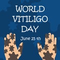 Classic blue World vitiligo day with hand.