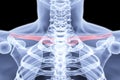 Clavicle Royalty Free Stock Photo