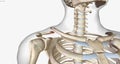 A clavicle fracture is a break in the collarbone, one of the bones in the shoulder