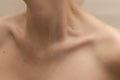 Clavicles and neck of a woman with moles on the skin