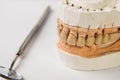 Clay mold human gums model in jaws prosthetic laboratory