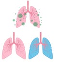 Clean lungs set for medicine. Coronavirus respiratory