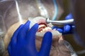 Cleaning teeth from plaque, tartar removal, teeth whitening, hands of a dentist close up