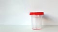 Clear Urine collection container with red cap. Medical specimen cup for testing. Concept of diagnostic procedures, urine